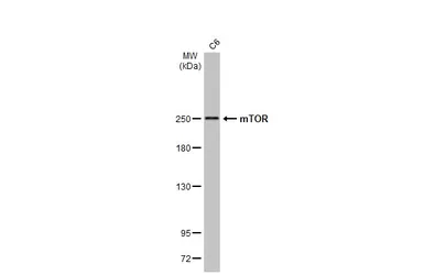 Anti-mTOR antibody [HL2217] used in Western Blot (WB). GTX638221