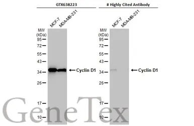 Anti-Cyclin D1 antibody [HL2219] used in Western Blot (WB). GTX638223
