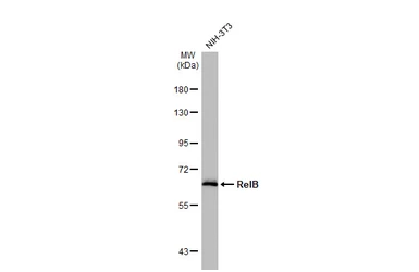 Anti-RelB antibody [HL2222] used in Western Blot (WB). GTX638267