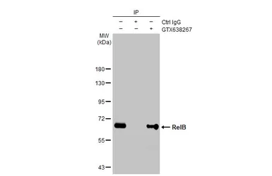 Anti-RelB antibody [HL2222] used in Immunoprecipitation (IP). GTX638267