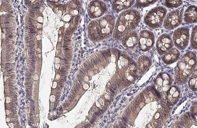 Anti-FN3K antibody [HL2223] used in IHC (Paraffin sections) (IHC-P). GTX638268