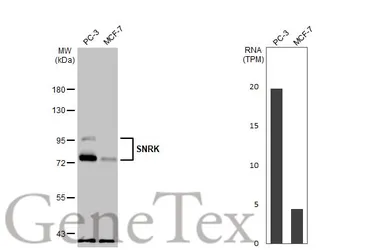 Anti-SNRK antibody [HL2225] used in Western Blot (WB). GTX638270