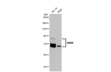 Anti-SNRK antibody [HL2225] used in Western Blot (WB). GTX638270