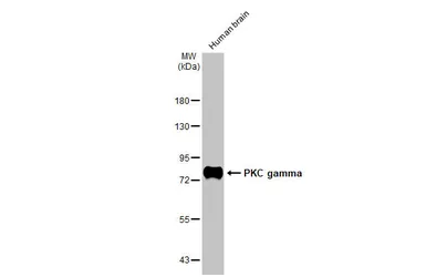 Anti-PKC gamma antibody [HL2226] used in Western Blot (WB). GTX638271