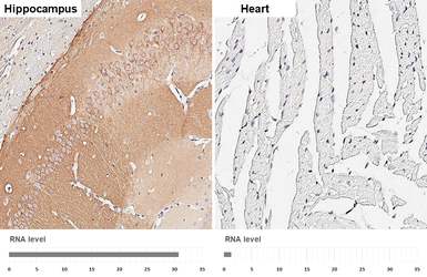 Anti-PKC gamma antibody [HL2226] used in IHC (Paraffin sections) (IHC-P). GTX638271