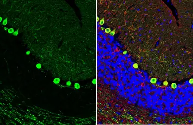 Anti-PKC gamma antibody [HL2226] used in IHC (Paraffin sections) (IHC-P). GTX638271
