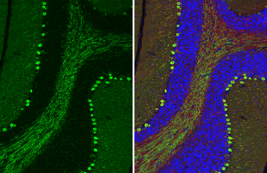 Anti-PKC gamma antibody [HL2226] used in IHC (Paraffin sections) (IHC-P). GTX638271