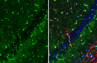 Anti-S100 beta antibody [HL2228] used in IHC (Paraffin sections) (IHC-P). GTX638273