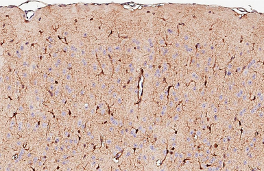 Anti-S100 beta antibody [HL2228] used in IHC (Paraffin sections) (IHC-P). GTX638273