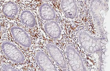 Anti-S100 beta antibody [HL2228] used in IHC (Paraffin sections) (IHC-P). GTX638273