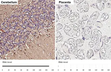 Anti-S100 beta antibody [HL2228] used in IHC (Paraffin sections) (IHC-P). GTX638273