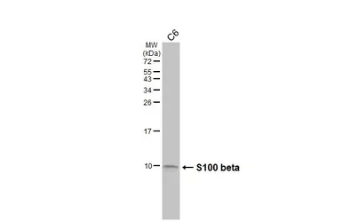 Anti-S100 beta antibody [HL2228] used in Western Blot (WB). GTX638273