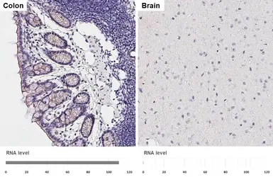 Anti-TMPRSS2 antibody [HL2229] used in IHC (Paraffin sections) (IHC-P). GTX638274