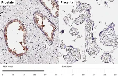 Anti-TMPRSS2 antibody [HL2229] used in IHC (Paraffin sections) (IHC-P). GTX638274
