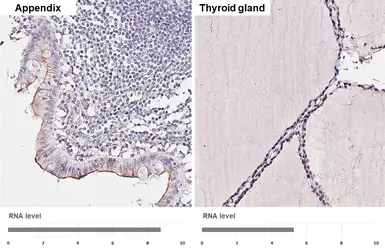Anti-TMPRSS2 antibody [HL2229] used in IHC (Paraffin sections) (IHC-P). GTX638274