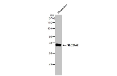 Anti-SLC27A2 antibody [HL2232] used in Western Blot (WB). GTX638277