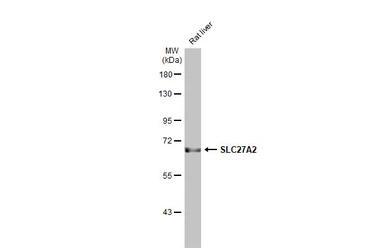 Anti-SLC27A2 antibody [HL2232] used in Western Blot (WB). GTX638277