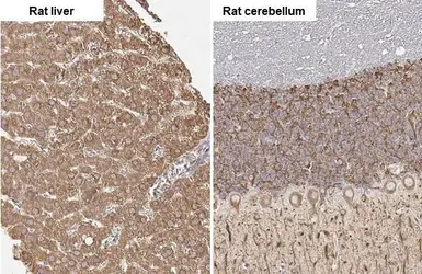 Anti-SLC27A2 antibody [HL2232] used in IHC (Paraffin sections) (IHC-P). GTX638277