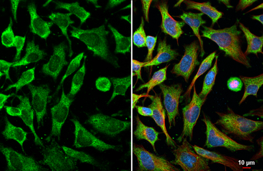 Anti-MLK4 antibody [HL2234] used in Immunocytochemistry/ Immunofluorescence (ICC/IF). GTX638279