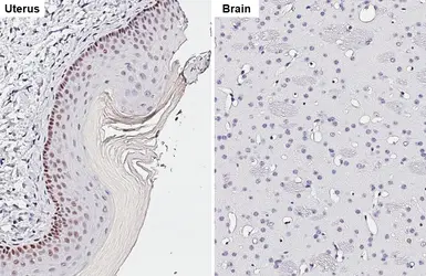 Anti-p53 antibody [HL2242] used in IHC (Paraffin sections) (IHC-P). GTX638291