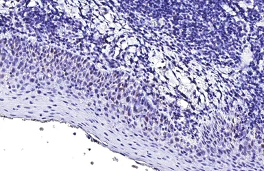 Anti-p53 antibody [HL2242] used in IHC (Paraffin sections) (IHC-P). GTX638291