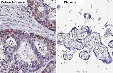Anti-p53 antibody [HL2242] used in IHC (Paraffin sections) (IHC-P). GTX638291