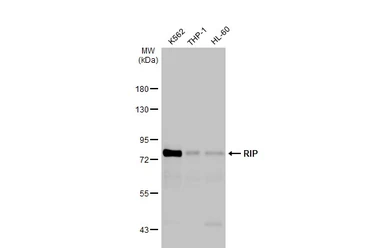 Anti-RIP antibody [HL2249] used in Western Blot (WB). GTX638298