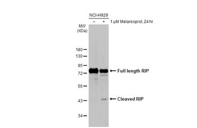 Anti-RIP antibody [HL2250] used in Western Blot (WB). GTX638299