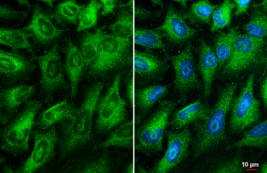 Anti-RIP antibody [HL2250] used in Immunocytochemistry/ Immunofluorescence (ICC/IF). GTX638299
