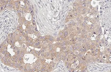 Anti-RIP antibody [HL2250] used in IHC (Paraffin sections) (IHC-P). GTX638299