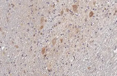 Anti-SDHB antibody [HL2251] used in IHC (Paraffin sections) (IHC-P). GTX638300