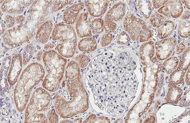 Anti-SDHB antibody [HL2251] used in IHC (Paraffin sections) (IHC-P). GTX638300