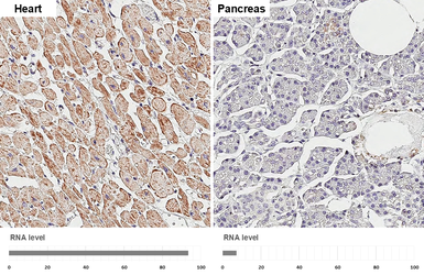 Anti-SDHB antibody [HL2251] used in IHC (Paraffin sections) (IHC-P). GTX638300