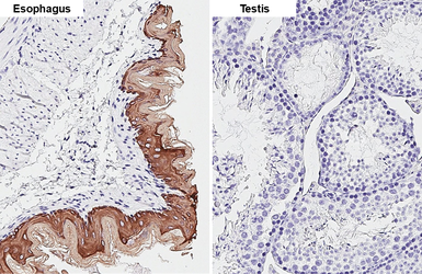 Anti-pan Cytokeratin antibody [HL2253] used in IHC (Paraffin sections) (IHC-P). GTX638302