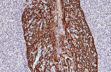 Anti-pan Cytokeratin antibody [HL2253] used in IHC (Paraffin sections) (IHC-P). GTX638302