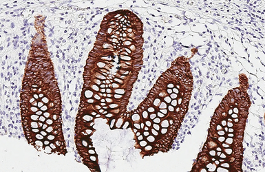 Anti-pan Cytokeratin antibody [HL2253] used in IHC (Paraffin sections) (IHC-P). GTX638302