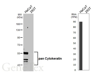 Anti-pan Cytokeratin antibody [HL2253] used in Western Blot (WB). GTX638302