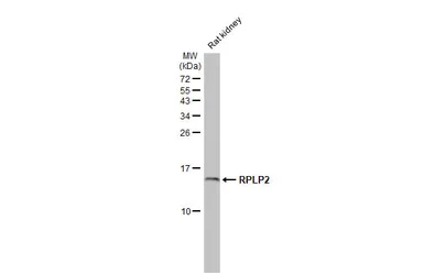 Anti-RPLP2 antibody [HL2256] used in Western Blot (WB). GTX638308