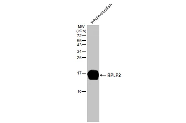 Anti-RPLP2 antibody [HL2256] used in Western Blot (WB). GTX638308