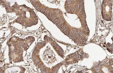 Anti-RPLP2 antibody [HL2256] used in IHC (Paraffin sections) (IHC-P). GTX638308