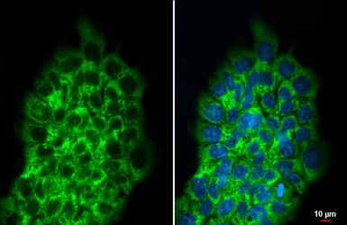Anti-RPLP2 antibody [HL2256] used in Immunocytochemistry/ Immunofluorescence (ICC/IF). GTX638308