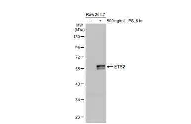 Anti-ETS2 antibody [HL2258] used in Western Blot (WB). GTX638310