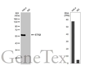 Anti-ETS2 antibody [HL2259] used in Western Blot (WB). GTX638311