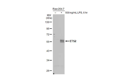 Anti-ETS2 antibody [HL2259] used in Western Blot (WB). GTX638311