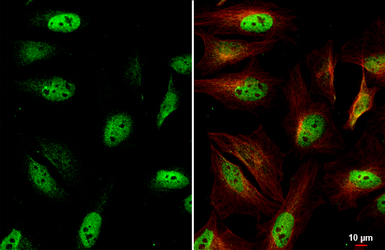 Anti-ETS2 antibody [HL2259] used in Immunocytochemistry/ Immunofluorescence (ICC/IF). GTX638311