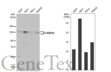 Anti-CARD10 antibody [HL2260] used in Western Blot (WB). GTX638312