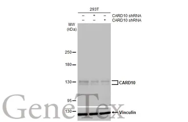 Anti-CARD10 antibody [HL2260] used in Western Blot (WB). GTX638312