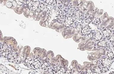 Anti-CARD10 antibody [HL2260] used in IHC (Paraffin sections) (IHC-P). GTX638312
