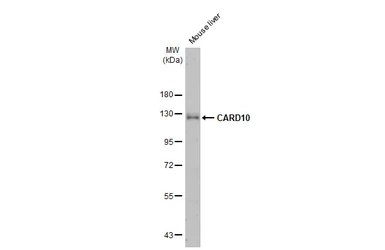Anti-CARD10 antibody [HL2260] used in Western Blot (WB). GTX638312