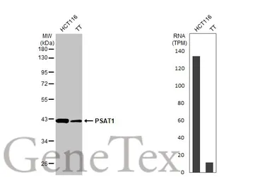 Anti-PSAT1 antibody [HL2270] used in Western Blot (WB). GTX638322